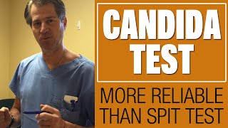 What Does Candida Look Like How to Know if You Have Candida [upl. by Aneeg961]