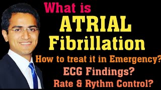 ATRIAL FIBRILLATION AFIB TREATMENT ECG INTERPRETATION PATHOPHYSIOLOGY AFIB MANAGEMENT LECTURE [upl. by Hilbert547]