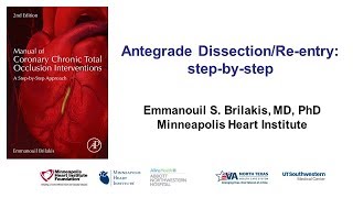 Antegrade dissection and reentry stepbystep [upl. by Ylyl]