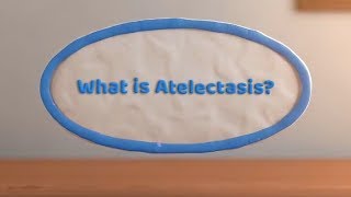 What is Atelectasis Complete or Partial Lung Collapse [upl. by Nedrob]