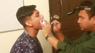 Oral Cavity Examination in case of Chronic tonsillitis [upl. by Nudnarb]