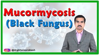 Mucormycosis  Black fungus disease in Covid 19 Causes Signs amp Symptoms Diagnosis and Treatment [upl. by Eelir861]