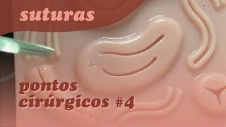 Tipos de Suturas  Pontos Cirúrgicos 04 [upl. by Hairehcaz]