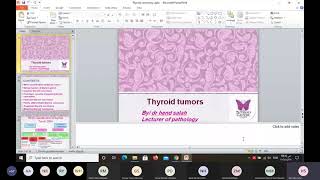 thyroid tumors [upl. by Hennahane]