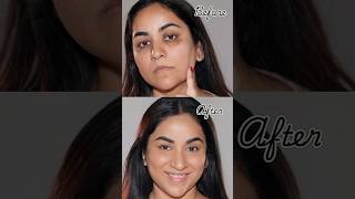 NO Foundation amp Concealer How to Cover Dark Circles Spots amp Scars [upl. by Biagio]