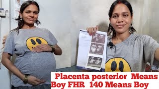 Placenta Posterior Means Boy FHR 140 Means Boy 🤰 [upl. by Wons]