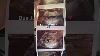 Baby loading DUE JUNE 1st 2025 Stay tuned 😘💗💙 babynumber9 pregnancy fyp shorts viral love [upl. by Mcdonald]