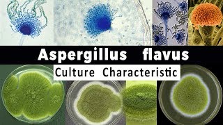 Aspergillus Flavus Culture Characteristic [upl. by Connelly419]