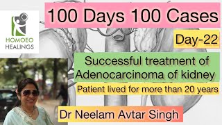 100 DAYS 100 CASES  DAY22 ADENOCARCINOMA OF KIDNEY  DR NEELAM AVTAR SINGH  VIDEO 194 [upl. by Oecam411]