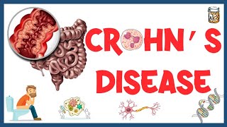 Crohns Disease  Causes Pathogenesis Clinical Presentation Diagnosis amp Treatment [upl. by Awahsoj357]