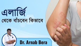 এলার্জি কেন হয় এলার্জি থেকে মুক্তির উপায়  Allergy Symptoms Causes amp Treatment  Episode No486 [upl. by Oirromed]