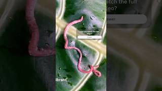 🪱🌱Parasitic worms helminths parasitic parasiticworm worms helminth pinkworms earthworm asmr [upl. by Borras933]