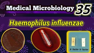 Haemophilus influenzae شرح بالعربي [upl. by Neenaj]