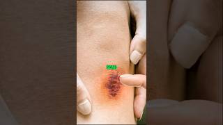 How to get rid of a scab shorts facts amazingfacts satisfying viralshorts viral [upl. by Cathrine]