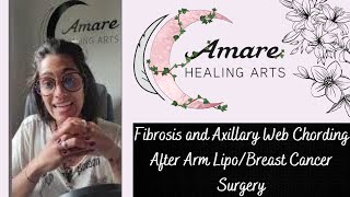 Fibrosis and Axillary Web Chording After Arm LipoBreast Cancer Surgery [upl. by Camellia]