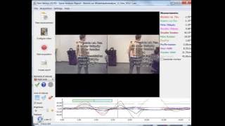 Spine Analysis protocol 3D in Simi Aktisys [upl. by Ida]