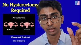 Adenomyosis Treatment No Hysterectomy Needed  Antai Hospitals [upl. by Lerner782]