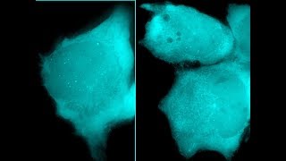 Firstever live tracking of HIV1 based lentiviral vectors in human cells [upl. by Ttenaej940]