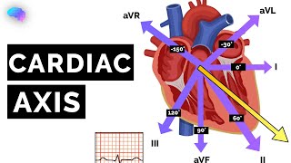 Cardiac Axis Explained  ECG  EKG  OSCE Guide  UKMLA  CPSA [upl. by Fillian]