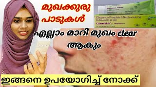 Clinmiskin gel clindamycin Review Malayalam  മുഖക്കുരു മാറാൻ ഈ cream മതിയോ  Ourlifeamppharma [upl. by Saraiya]