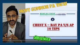 CHEST X RAY PA VS AP VIEW 10 DIFFERENCES  REFLECTION 4 [upl. by Willing751]