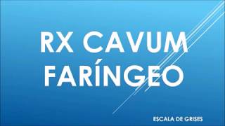 RADIOGRAFIA DE CAVUM FARINGEO [upl. by Jacie]