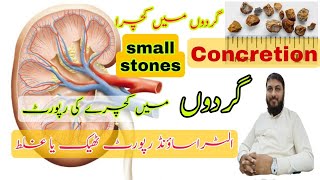 Concretion in kidneys  Ultrasound KUB Urdu Hindi  stones report  Gurdo me kachra  Gurdo me pathr [upl. by Murdocca]