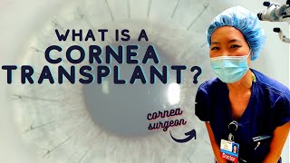 Cornea Surgeon Explains What is a Cornea Transplant  Top 3 Reasons For Cornea Surgery [upl. by Marta449]