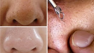 How To Do Facial Clean Up At Home Step By Step For Spotless Clear Skin Rabia Skincare [upl. by Noyrb]