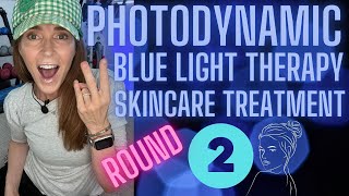 Photodynamic Blue Light Treatment Part 2  Removes Actinic Keratosis amp Rejuvenates Your Skin 🙌🏼 [upl. by Geminian410]