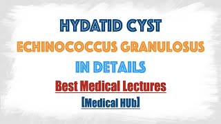 Hydatid cyst of Echinococcus granulosusDog tapeworm  Discussed in details everything you need [upl. by Hare]