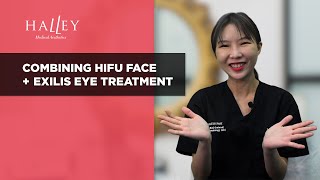 Combining HIFU Face Lifting amp Exilis Ultra 360 Eye Treatments [upl. by Anos538]