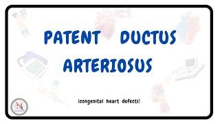 PATENT DUCTUS ARTERIOSUS  Causes  Symptoms  Pathophysiology  Treatment  The Nurses Station [upl. by Lindsley]