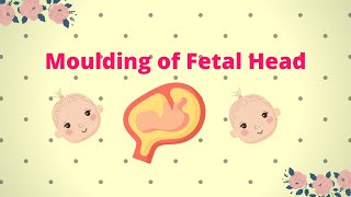 Moulding of Fetal Head  DefinitionProcessGradingClinical Importance and Treatment [upl. by Eldon]