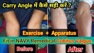 Carry Angle कैसे सही करें How my brother Fit in Navy Remedical  Exercise  Apparatus  Best Tips [upl. by Schell213]