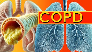 COPD Explained How to Spot Early Symptoms Before Its Too Late [upl. by Atinuhs307]