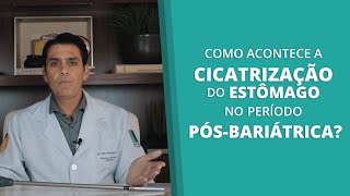 Como acontece a cicatrização do estômago no período pósbariátrica [upl. by Znieh674]