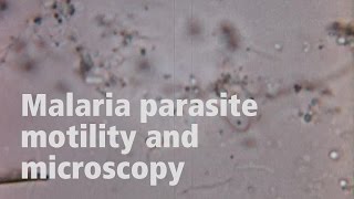 Jake Baum on the motility of malaria parasites [upl. by Ashli570]