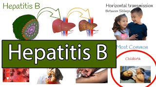 Hepatitis B symptoms treatment and prevention [upl. by Clymer772]