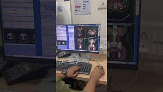 3D reconstruction ct Urography ctscan ctscantechnician trendingshorts tyshorts shortvideo [upl. by Daley]