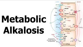 Metabolic Alkalosis [upl. by Elraet]