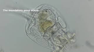 Brachionus Rotifer  The Basics [upl. by Allissa]