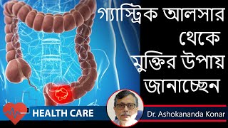 Peptic Ulcer Symptoms  কোন লক্ষণ গুলি হলে বুঝবেন গ্যাস্ট্রিক আলসার হয়েছে  Dr Ashokananda Konar [upl. by Cl489]