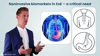 Eosinophilic Esophagitis EoE  Differentiating Patients with Bloodbased Collagen Biomarkers [upl. by Mandel]