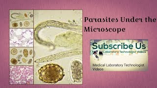 Parasites Under The Microscope [upl. by Egin]