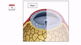 General Embryology  Detailed Animation On Gastrulation [upl. by Konyn]