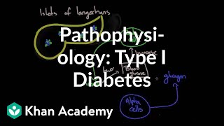 Pathophysiology  Type I diabetes  Endocrine system diseases  NCLEXRN  Khan Academy [upl. by Auohp]