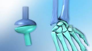 Condyloid Joint animation [upl. by Eslud]