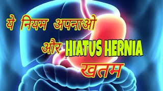 Hiatus hernia ka ayurvedic upchar  Rule for hiatus hernia in Hindi [upl. by Cuyler716]