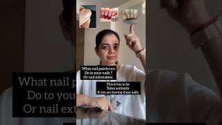 Nail damage treatment permanentcure homoeopathytreatment damagenails youtubeshorts brunomars [upl. by Breech]